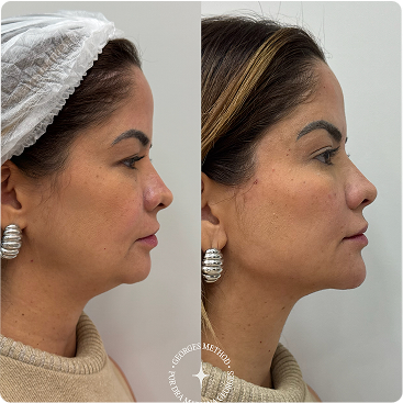 PHOTO-2025-05-11-22-46-03 4